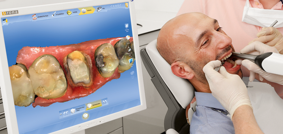 Zahnersatz in einer Sitzung - Digitale Zahnheilkunde